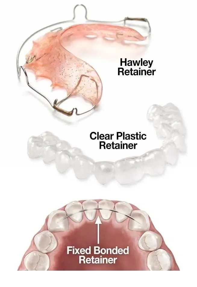 Retainers